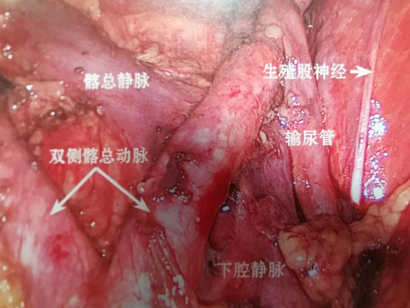 圖片 3