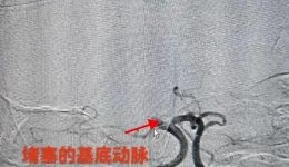 強化黨建引領(lǐng)優(yōu)勢，聚力卒中救治再創(chuàng)新高